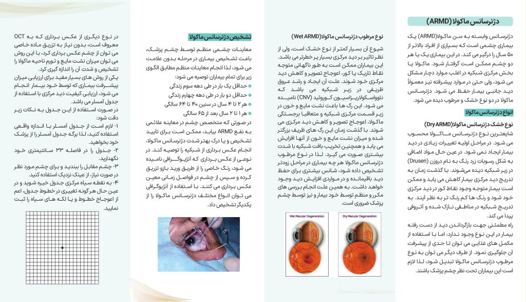 دژنرسانس وابسته به سن ماکولا

Age-Related Macular Degeneration