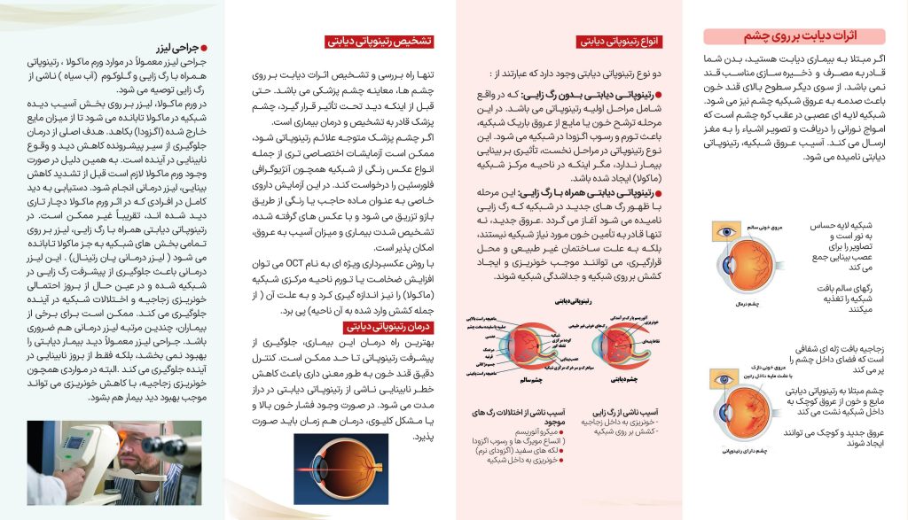 رتینوپاتی دیابتی

Diabetic Retinopathy